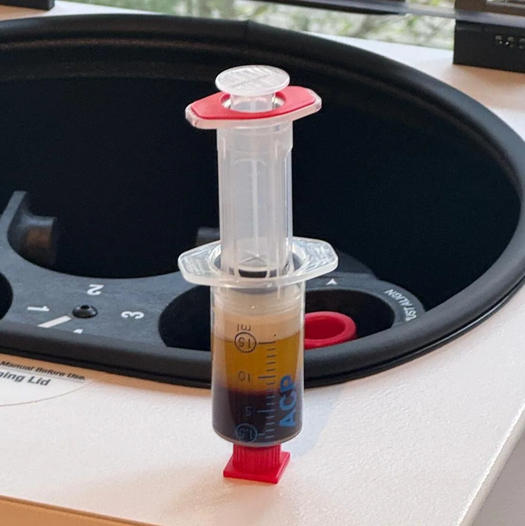Blutprobe in der Zentrifuge